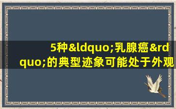 5种“乳腺癌”的典型迹象可能处于外观后乳腺癌的中期和晚期