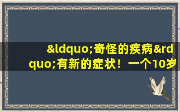 “奇怪的疾病”有新的症状！一个10岁男孩离开村庄后睡着的原因是什么？