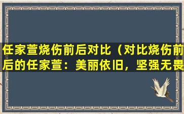 任家萱烧伤前后对比（对比烧伤前后的任家萱：美丽依旧，坚强无畏）