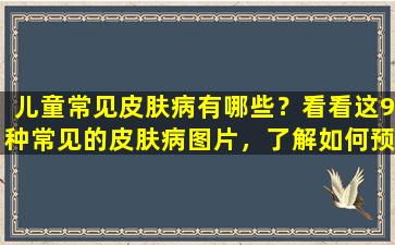儿童常见皮肤病有哪些？看看这9种常见的皮肤病图片，了解如何预防和治疗！