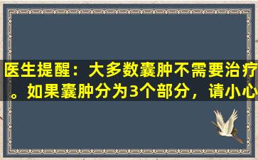 医生提醒：大多数囊肿不需要治疗。如果囊肿分为3个部分，请小心。