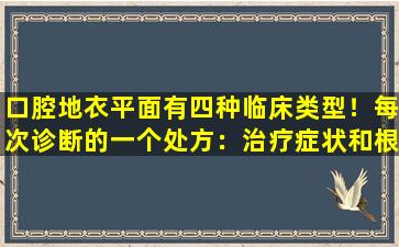 口腔地衣平面有四种临床类型！每次诊断的一个处方：治疗症状和根本原因以提高治愈率