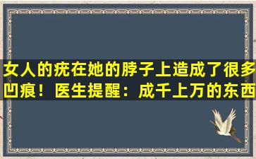 女人的疣在她的脖子上造成了很多凹痕！医生提醒：成千上万的东西变得美丽，首先是安全！