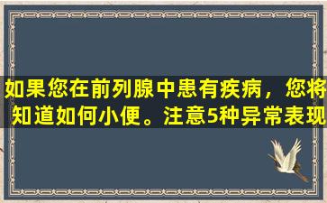 如果您在前列腺中患有疾病，您将知道如何小便。注意5种异常表现或前列腺肥大的信号