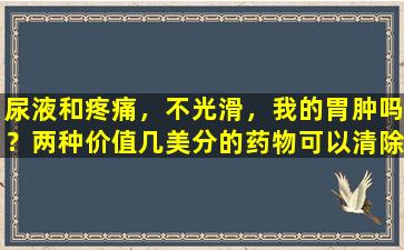 尿液和疼痛，不光滑，我的胃肿吗？两种价值几美分的药物可以清除血迹和清除孔，减轻热量并缓解凳子