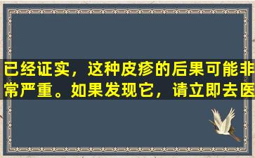 已经证实，这种皮疹的后果可能非常严重。如果发现它，请立即去医院。