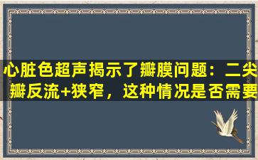 心脏色超声揭示了瓣膜问题：二尖瓣反流+狭窄，这种情况是否需要治疗？
