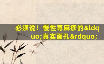 必须说！慢性荨麻疹的“真实面孔”