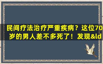 民间疗法治疗严重疾病？这位70岁的男人差不多死了！发现“秘密食谱”背后的黑色工业链