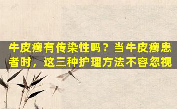 牛皮癣有传染性吗？当牛皮癣患者时，这三种护理方法不容忽视