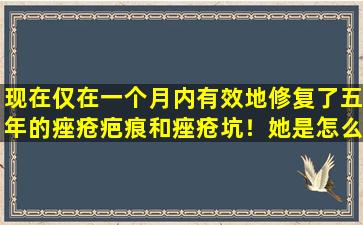 现在仅在一个月内有效地修复了五年的痤疮疤痕和痤疮坑！她是怎么做到的
