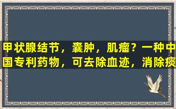 甲状腺结节，囊肿，肌瘤？一种中国专利药物，可去除血迹，消除痰液和分散结节和求解结节