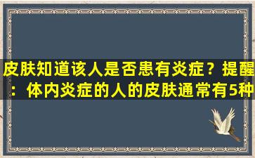 皮肤知道该人是否患有炎症？提醒：体内炎症的人的皮肤通常有5种症状