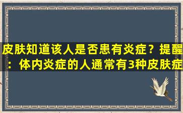 皮肤知道该人是否患有炎症？提醒：体内炎症的人通常有3种皮肤症状
