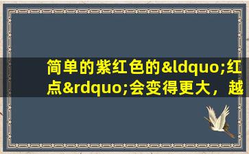 简单的紫红色的“红点”会变得更大，越来越多吗？医生的详细答案在这里！