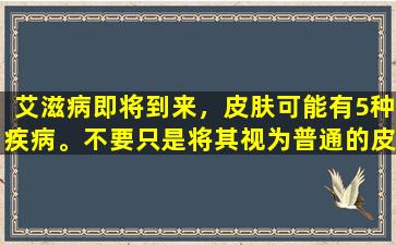 艾滋病即将到来，皮肤可能有5种疾病。不要只是将其视为普通的皮肤病。