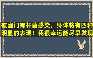 被幽门螺杆菌感染，身体将有四种明显的表现！我很幸运能尽早发现，远离胃癌