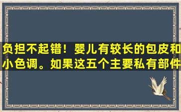 负担不起错！婴儿有较长的包皮和小色调。如果这五个主要私有部件异常，请立即寻求医疗治疗。